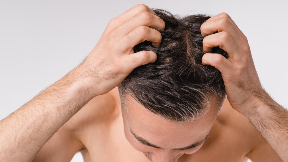 how to stop my hair from thinning