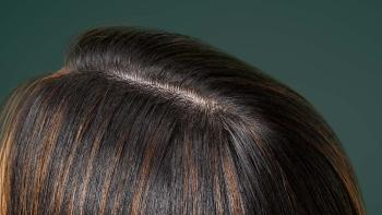 What is a healthy scalp environment and how can you achieve it?